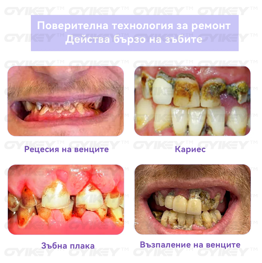 🔴𝑂𝑦𝑖𝑘𝑒𝑦™ Възстановяване На Зъби Минерална Пудра💋(BDA препоръчва)