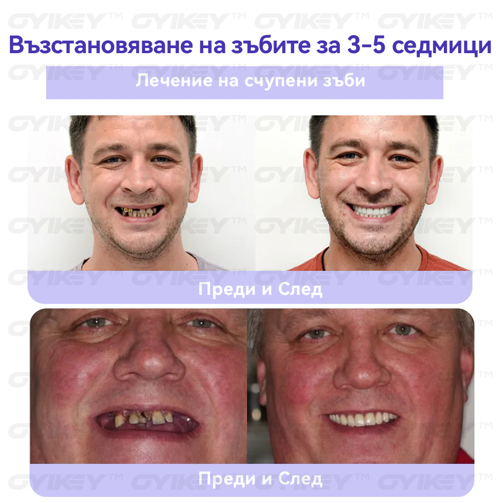 🔴𝑂𝑦𝑖𝑘𝑒𝑦™ Възстановяване На Зъби Минерална Пудра💋(BDA препоръчва)