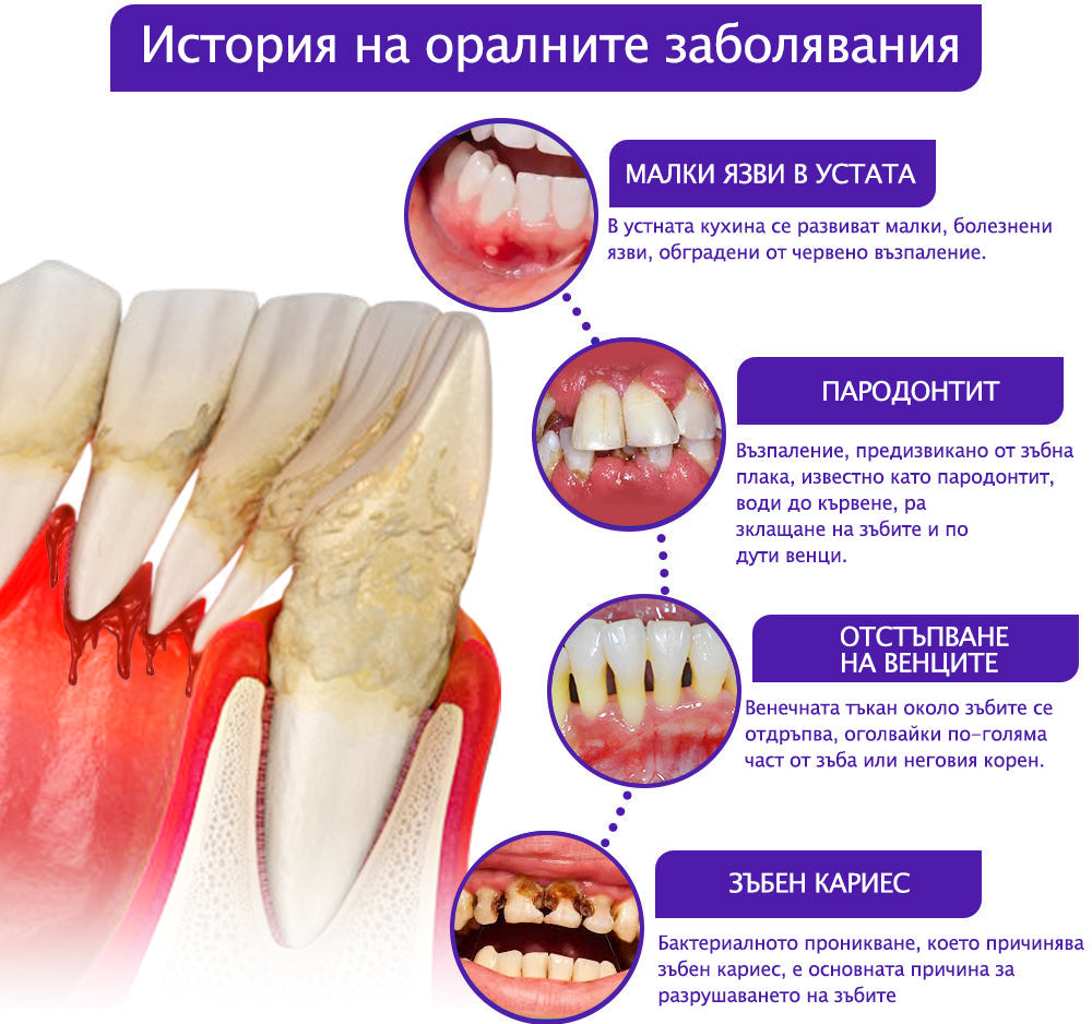 Паста за зъби Rolimey® ✨VioCore с пчелна отрова за венците 🛒