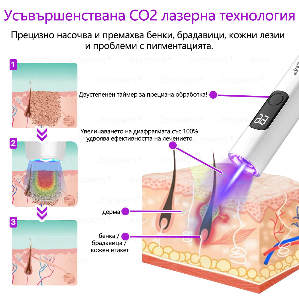 𝐉𝐚𝐬𝐬𝐞𝐞𝐦®✅ Усъвършенствана неинвазивна CO₂ лазерна писалка за грижа за кожата 💕(Нежно и ефективно премахва брадавици, бенки, старчески петна и кожни образувания – без болка и без усилие!) 📦