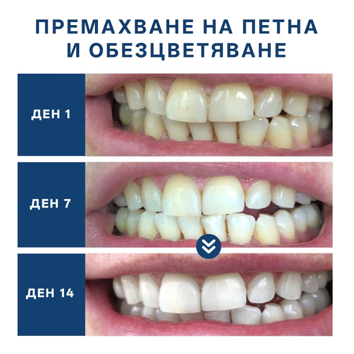 Устройство за лазерна грижа за усмивка Bikenda® — Блестяща усмивка · Здраве на венците · Ежедневна грижа