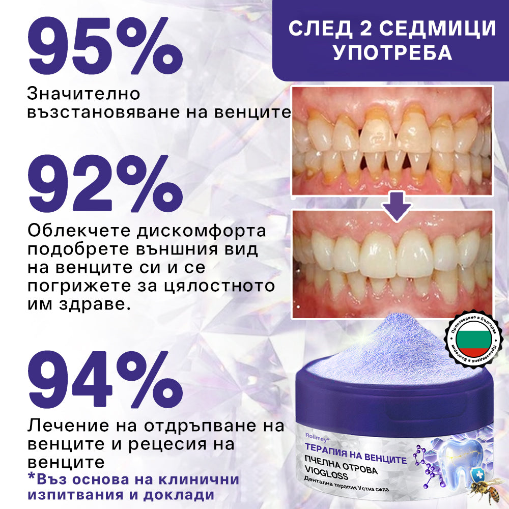 🦷Rolimey® VioGloss Дентална терапия с пчелна отрова Oral Power 🛒