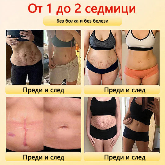 🎉 Предложение за ограничено време - огромна отстъпка! 🔥До 90% ОТСТЪПКА!💰 Sfrcord™ шорти с турмалинови оформящи влакна самонагряващи се 🔥