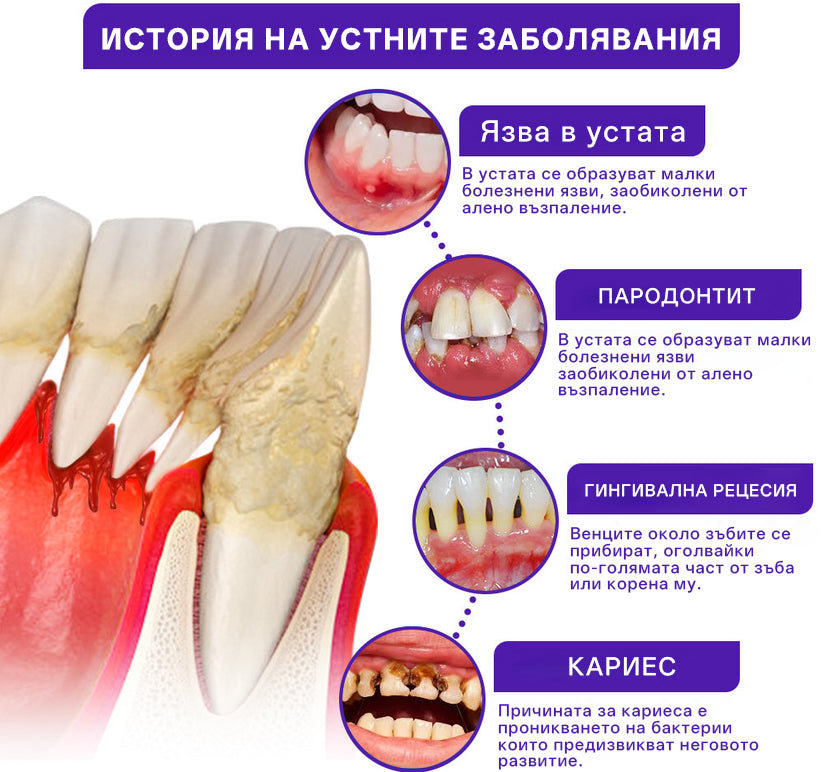 🦷Rolimey® VioGloss Дентална терапия с пчелна отрова Oral Power 🛒
