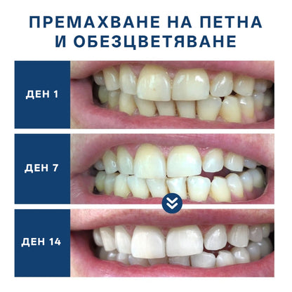 Устройство за лазерна грижа за усмивка Bikenda® — Блестяща усмивка · Здраве на венците · Ежедневна грижа