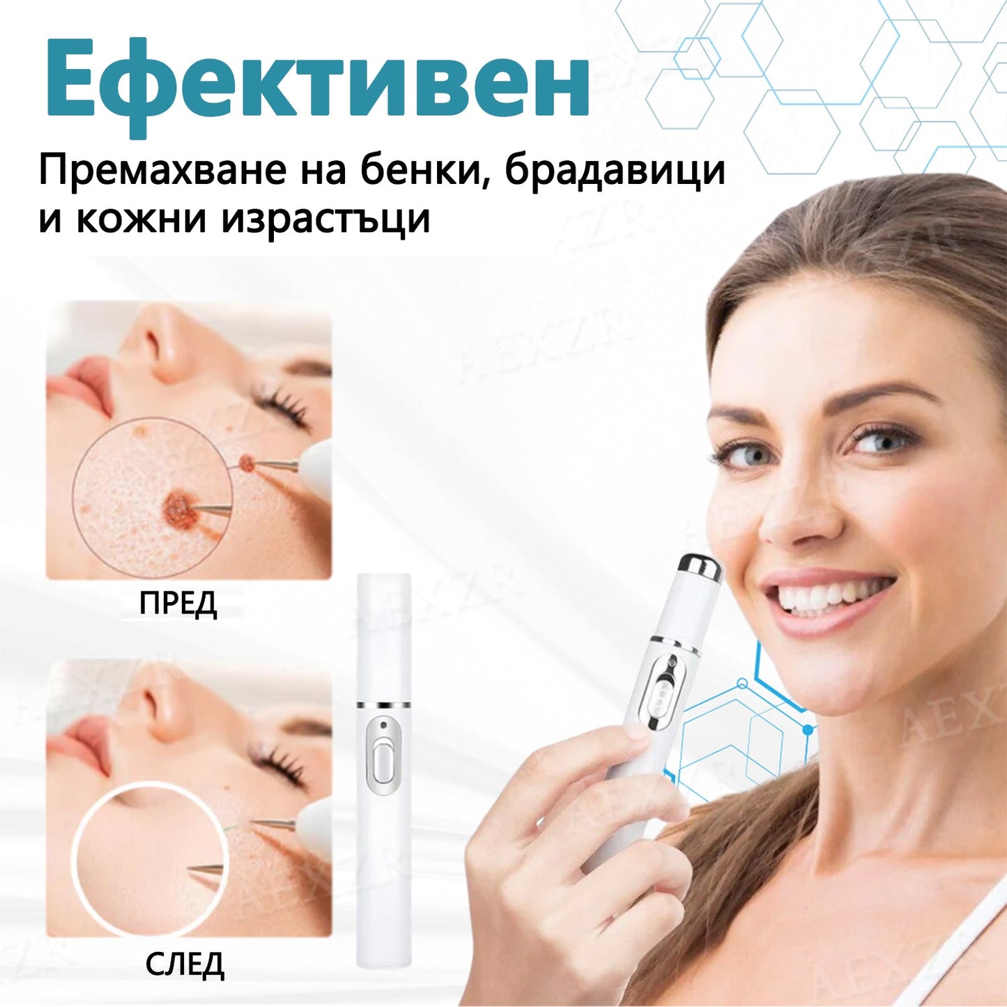 Bikenda®💎Неинвазивна лазерна писалка за премахване на бенки и брадавици  🛒