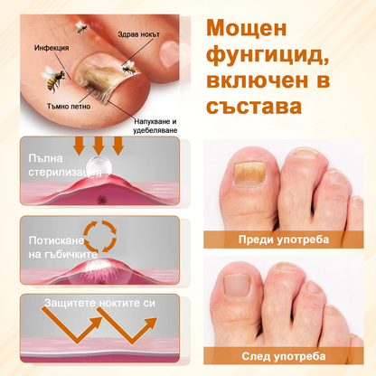 ATTDX® Fungiclear Пчелна Терапия Спрей за Нокти  🛒
