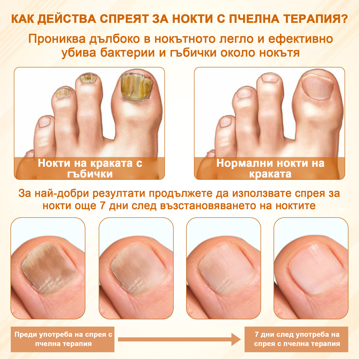ATTDX® Fungiclear Пчелна Терапия Спрей за Нокти  🛒