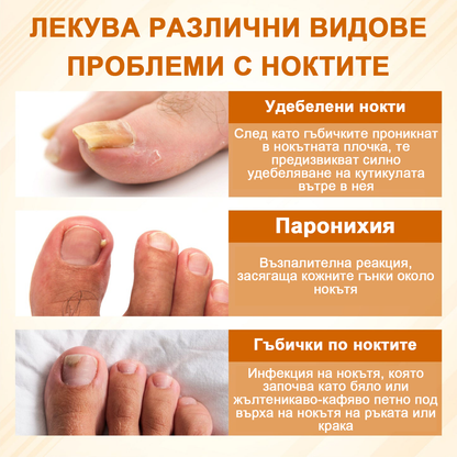 ATTDX® Fungiclear Пчелна Терапия Спрей за Нокти  🛒